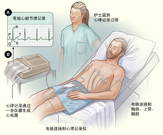 冠心病需要做哪些檢查？(圖1)